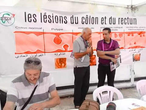 Affiche pédagogique montrant le côlon normal, le polype puis le cancer, devant des visiteurs.